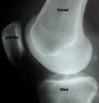 x ray of knee