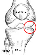 Illustration of medial compartment