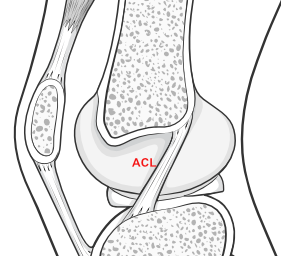 ACL - knee cut in half 