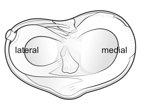 the shape of the medial and lateral menisci