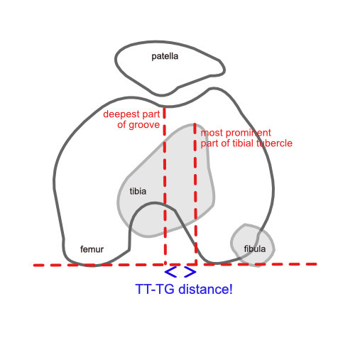 TT-TG distance
