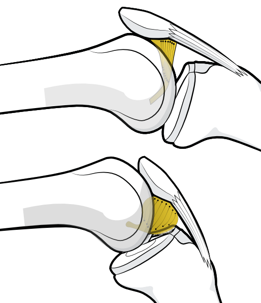 fat pad and its relationship to the ligamentum mucosum