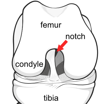 intercondylar notch