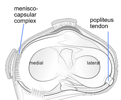medial versus lateral meniscus