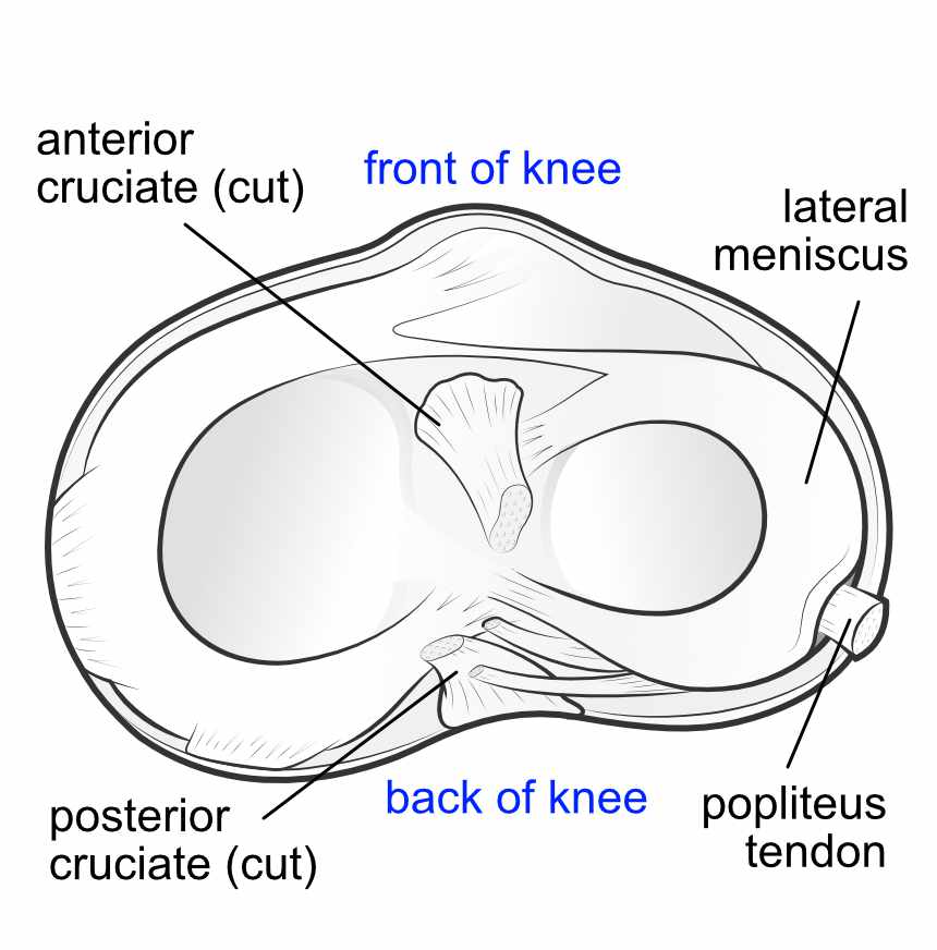 posterolateral corner from above